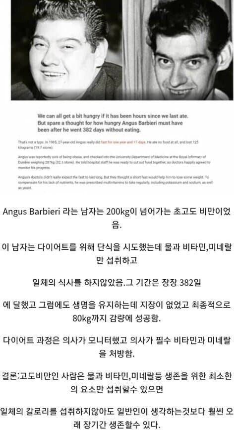 초고도비만은 얼마나 굶을 수 있을까.jpg(0)