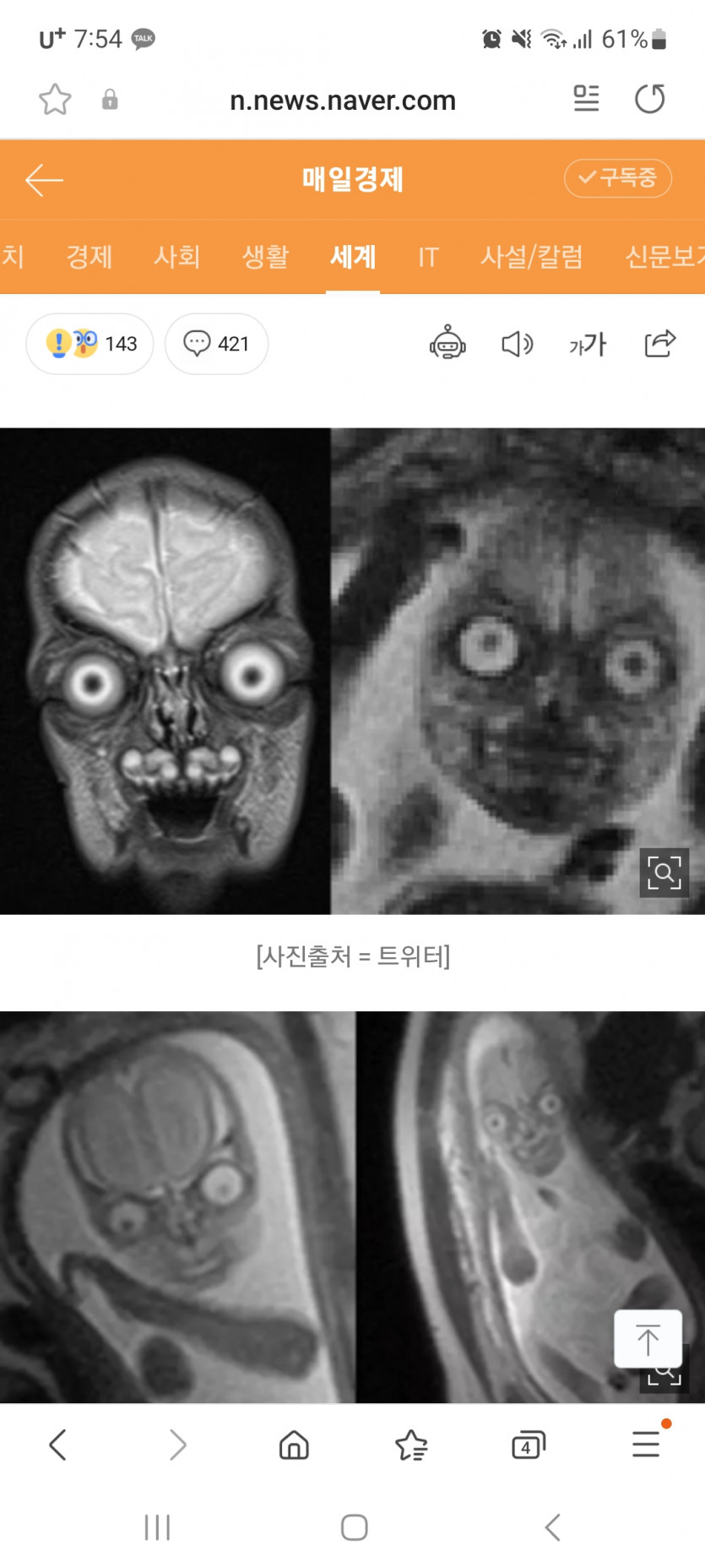 MRI로 찍은 임산부뱃속 태아모습(0)