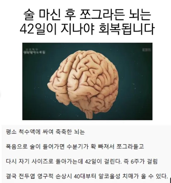 술먹으면 뇌가 쪼그라든다네요 ㅠㅠ(0)