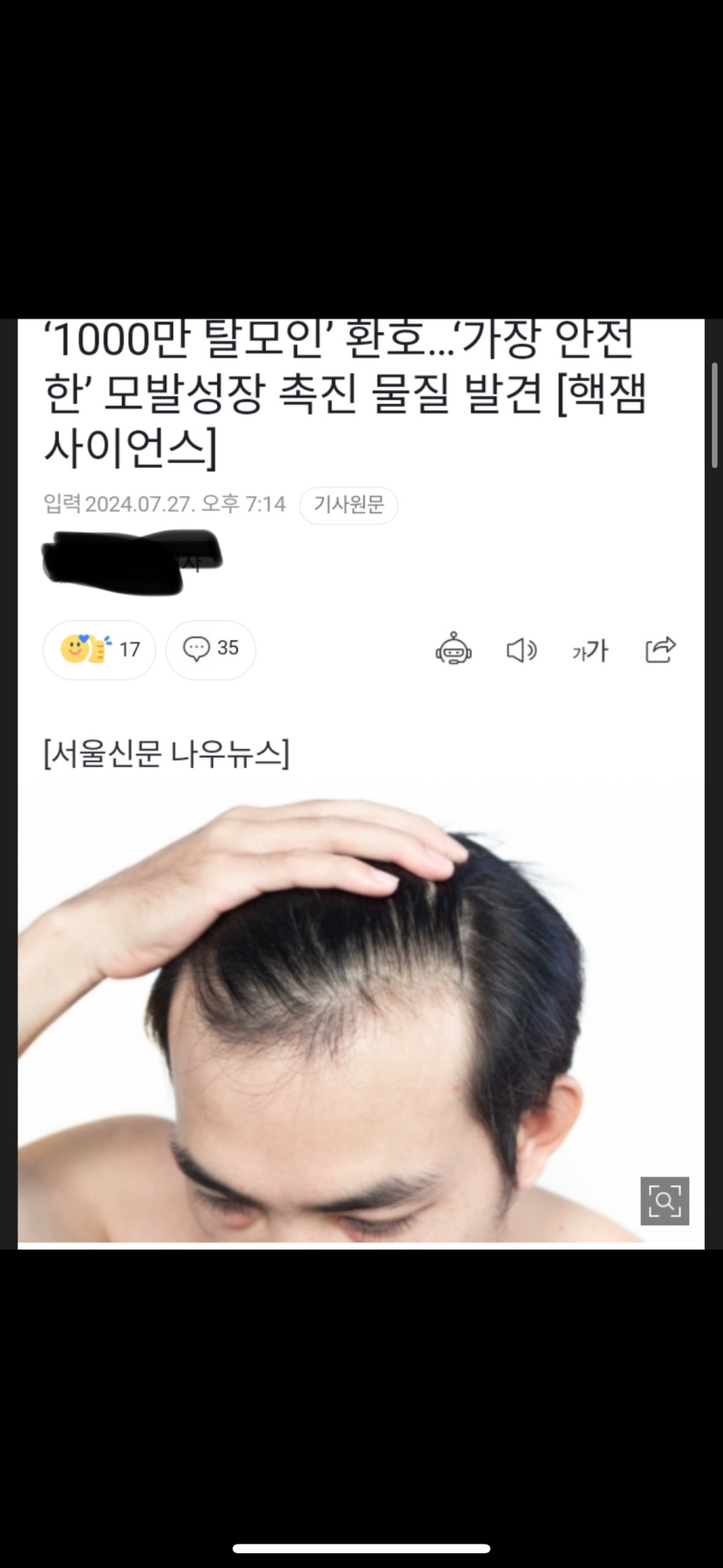 가장 안전한 탈모약 물질 발견(0)
