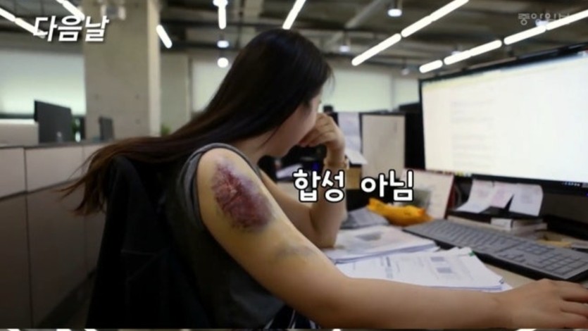 펜싱 칼에 찔리면 얼마나 아플까??(1)